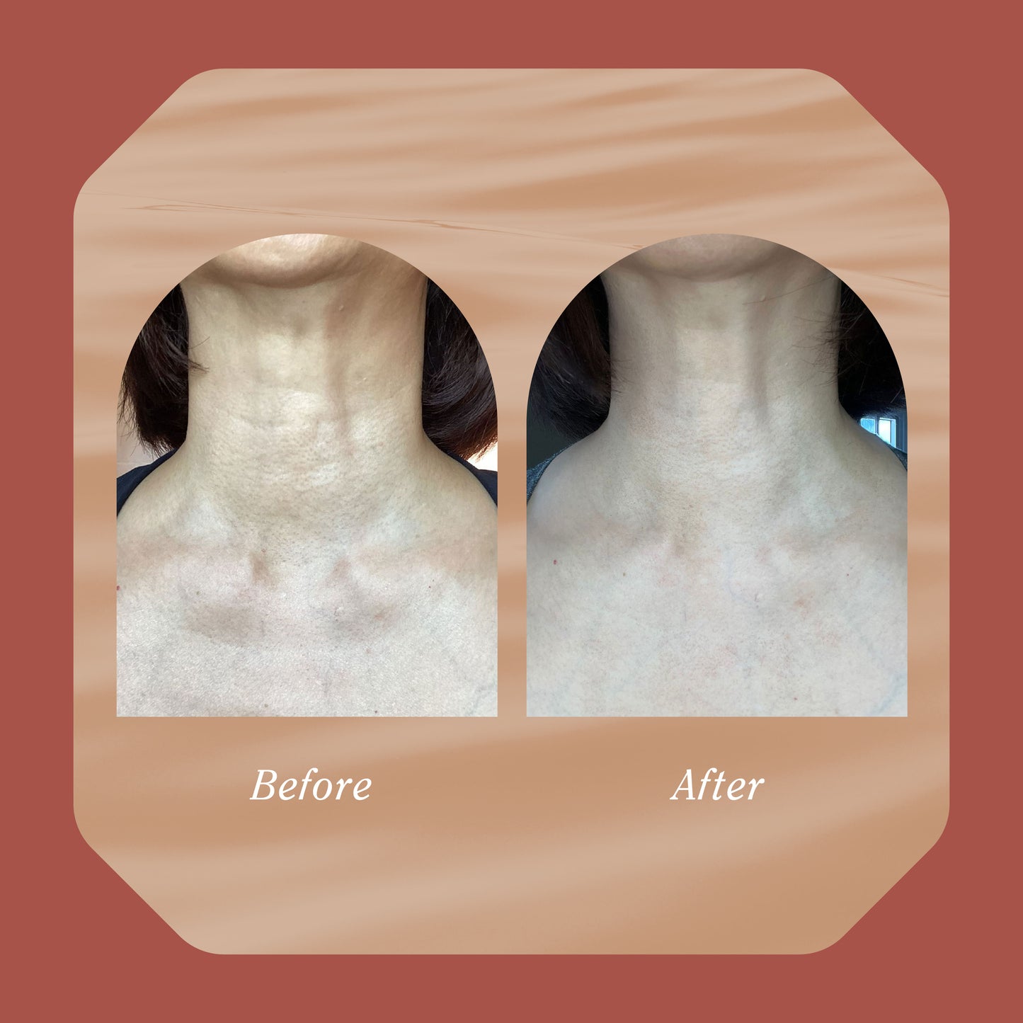 The Skin Reset Ritual - Décolletage - Progress Plan